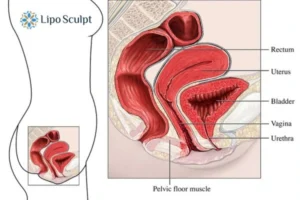 Treatment For A Leaky Bladder 2 How EM Chair treatment Leominster can help Leaky bladder issues. Read more now!